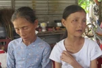 Thiếu nữ hóa bà lão tuổi 50: “Cuộc đời em như đóng sập lại”