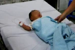 Bé sơ sinh ngộ độc nicotin vì bị mẹ tẩy lông tơ