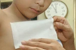  Bỏng, rát vì miếng dán làm ấm cơ thể