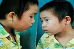 Bé 4 tuổi bị cô giáo tát: Phòng Giáo dục chỉ... tham mưu!