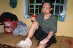Kinh hoàng 20 bệnh nhân phong Hà Nội bị bỏ đói và "ép" ăn thịt sống?