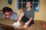 Trần tình của những nữ hộ lý “ép” bệnh nhân phong ăn thịt sống