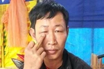 Dân say rượu bị Trưởng công an xã xịt hơi cay vào mặt