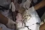 Video: Giải cứu bé 2 ngày tuổi kẹt trong đường ống thải của toilet
