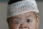 Bé gái 1 tuổi nhăn nheo như bà già