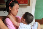 Sau vụ cháy ở HP: "Sống không bằng chết"