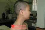 Cô gái 17 tuổi bị tra tấn, cạo trọc, xăm quái vật vào mặt