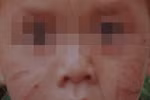 Tàn độc rạch mặt bé trai 20 tháng tuổi