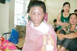 Tin tiếp vụ chồng dội nồi nước sôi vào vợ