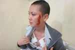 Gia đình cô gái bị xăm quái vật lên mặt phẫn nộ