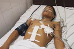 Chém người, cướp xe con đại gia đất Cảng