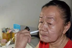 Cô gái hóa bà lão đã có hi vọng thoát khỏi lão hóa?