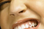 Éo le tai nạn đánh răng, nuốt chửng cả răng giả