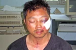 Kẻ cầm đầu băng cướp đấu súng với CS bị Interpol truy nã