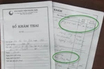 Siêu âm 10 lần sinh đôi, đẻ ra chỉ một