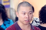 Diễn viên Hải Anh rụng 2 răng cửa khi đang ăn cơm
