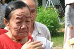 Đã có kết luận về cô gái 26 tuổi biến thành bà già