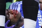 Drogba được xuất viện