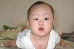 Cách chữa trị lác mắt ở trẻ nhỏ