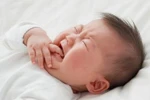 Cháu bé 5 tháng tuổi bị cắt gần 1m ruột