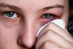 Phòng ngừa những bệnh dễ mắc phải vào mùa thu