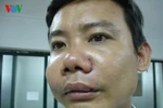 Nếu tôi là hiệu trưởng: Dạy võ thuật cho sinh viên báo chí