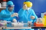 Giao nhiệm vụ đặt hàng xét nghiệm chẩn đoán COVID-19