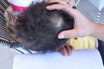 Giáo viên bị tố đánh “chấn động não” bé 3 tuổi