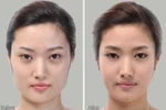 Công dụng "kinh hoàng" của phẫu thuật thẩm mĩ xứ Hàn