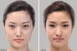 Công dụng "kinh hoàng" của phẫu thuật thẩm mĩ xứ Hàn