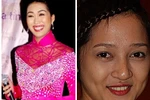  Khi mỹ nhân "thảm hại" vì ... răng