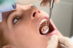 Bác sĩ "quên" gạc trong miệng bệnh nhân hơn nửa tháng