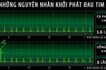 Ăn quá no làm tăng nguy cơ đau tim gấp 7 lần