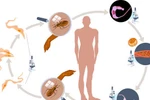 "Bệnh AIDS mới của châu Mỹ" do bọ xít hút máu