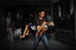 Những hình ảnh đầy chết chóc từ cuộc nội chiến ở Syria