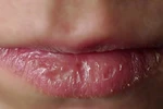 7 dấu hiệu báo động bạn không khỏe mạnh