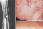 Những căn bệnh chỉ nghe tên đã "ớn lạnh" ở Việt Nam 