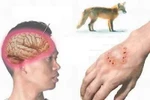 Ghê sợ: Bệnh dại - Nguyên nhân và cách phòng tránh