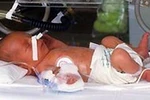 Bú sữa mẹ sớm giúp trẻ sinh non mau thoát khỏi lồng ấp