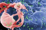  Cẩn thận với “thần dược” chữa HIV 