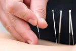 Những căn bệnh liên quan đến xương và cách phòng tránh