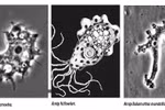 Điểm mặt các amip tự do gây viêm não