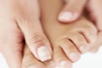 Mùa hè coi chừng bệnh nấm móng