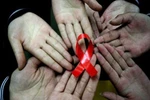 Những điều bạn thường lầm tưởng về HIV 