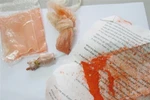  Hà Nội: Bé 8 tháng tuổi tử vong vì thuốc cam nhiễm chì