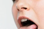 Những tiết lộ có thể không ngờ của lưỡi về sức khỏe của bạn