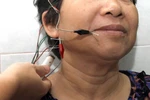 Cảnh báo: Méo mồm, liệt mặt vì... thức khuya 