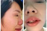 Bị đánh vì cho HS hạnh kiểm TB: GV làm đúng trách nhiệm lại trở thành nạn nhân?