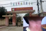 Phòng Giáo dục Sầm Sơn bác bỏ thông tin Hiệu trưởng bóp cổ 2 học sinh