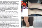 Khiển trách giáo viên đánh học sinh tại trường Nguyễn Tri Phương